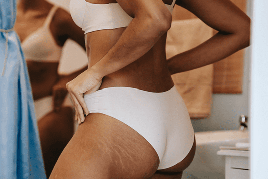 Comment lutter contre les vergetures blanches ?